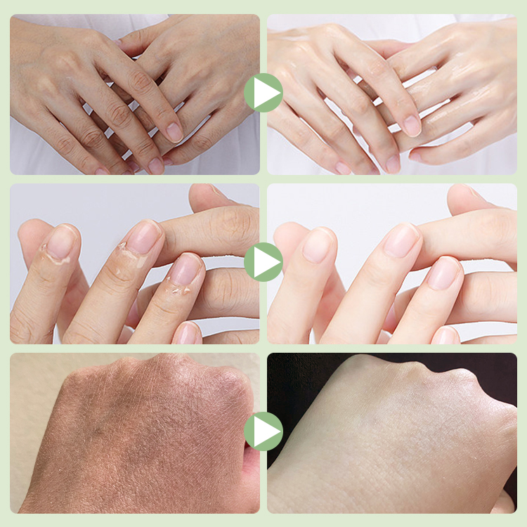 Esensi Tangan Favorit Manicurist Korea-Menutrisi tangan, menghilangkan duri/pengelupasan/sendi hitam dengan mudah