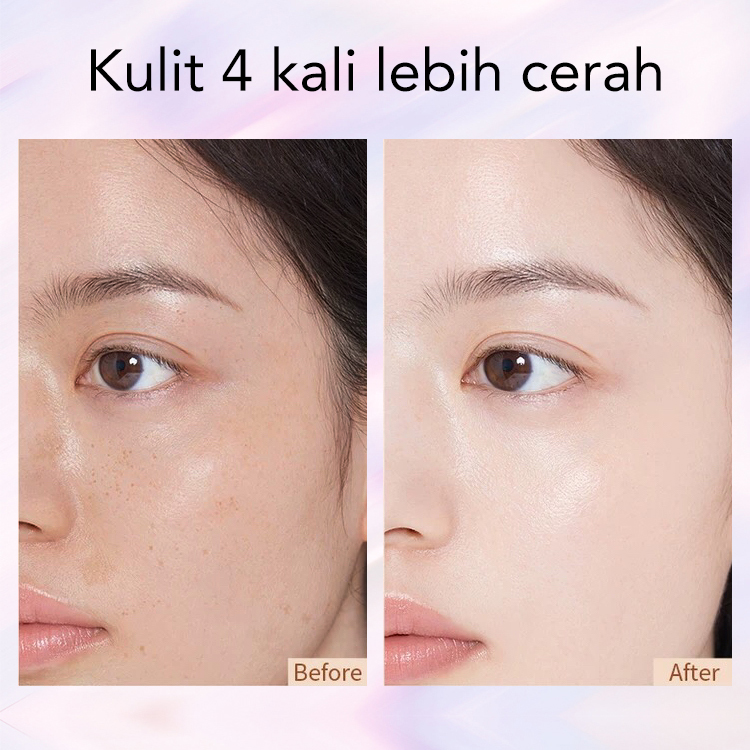 Krim Serum Niacinamide