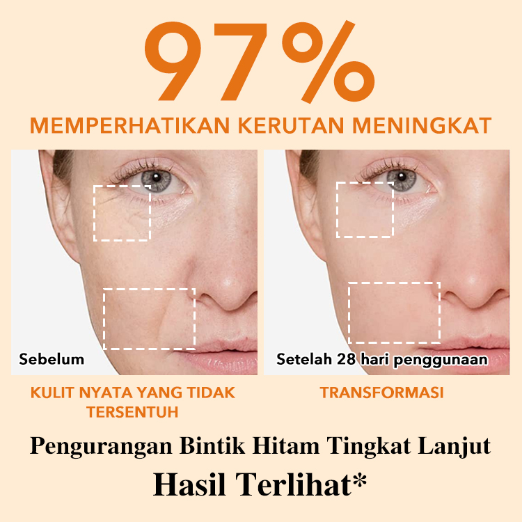 Ellen Ella 4X Retinol Kombo Anti Penuaan