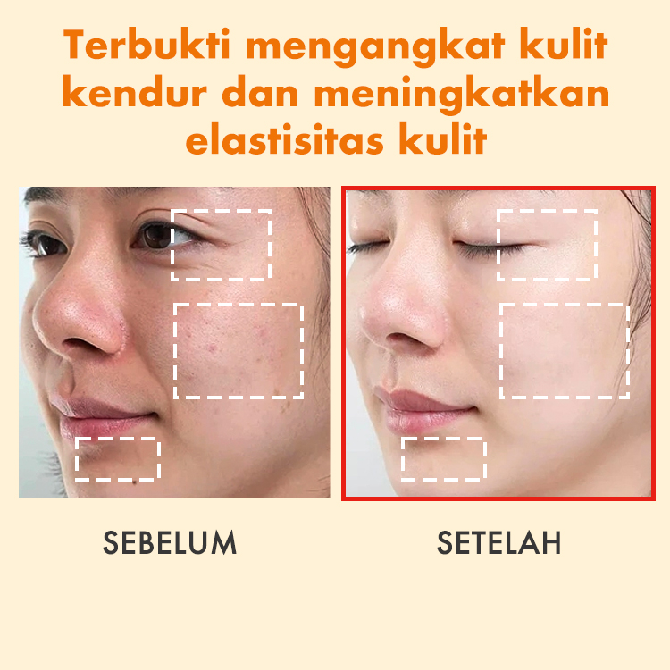 Ellen Ella Serum Retinol yang Ditingkatkan